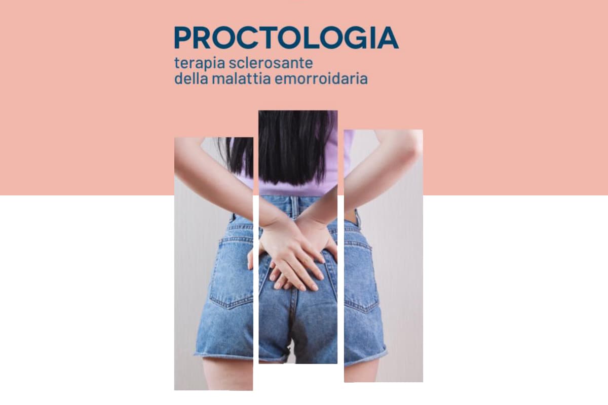 Procotologia Focus sulle emorroidi